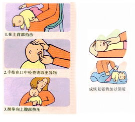 宝宝急救方法